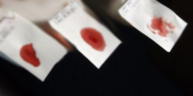 云南亲子鉴定机构需要怎么办理鉴定,云南亲子鉴定报告需要多久出来